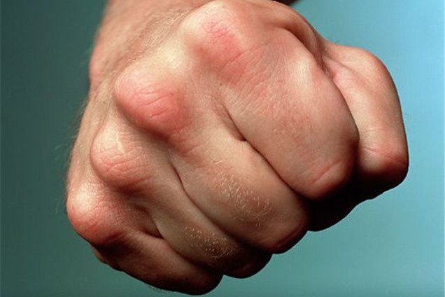 На Днепропетровщине произошла драка со стрельбой с участием судьи