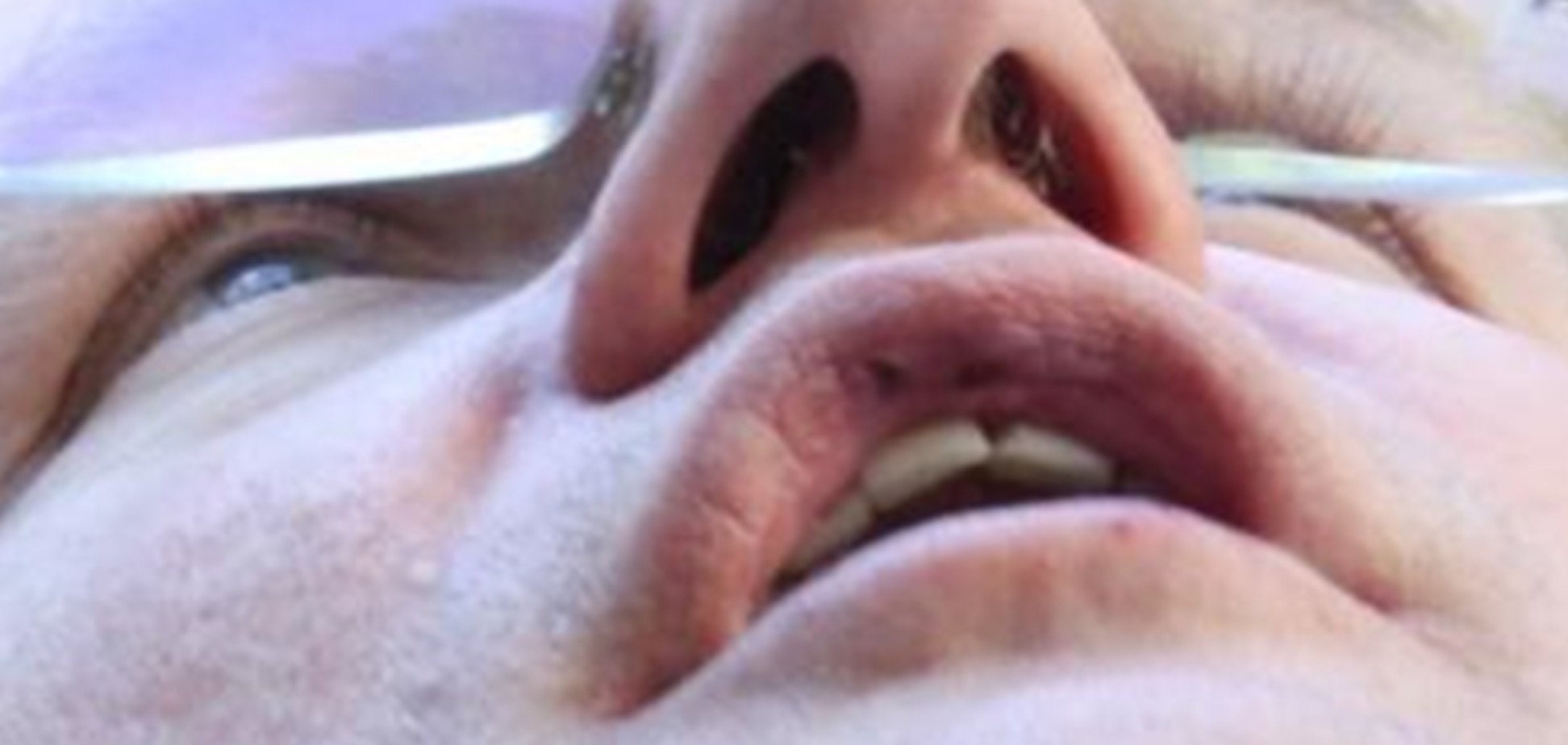 Мэр Львова продемонстрировал результаты нападения на него