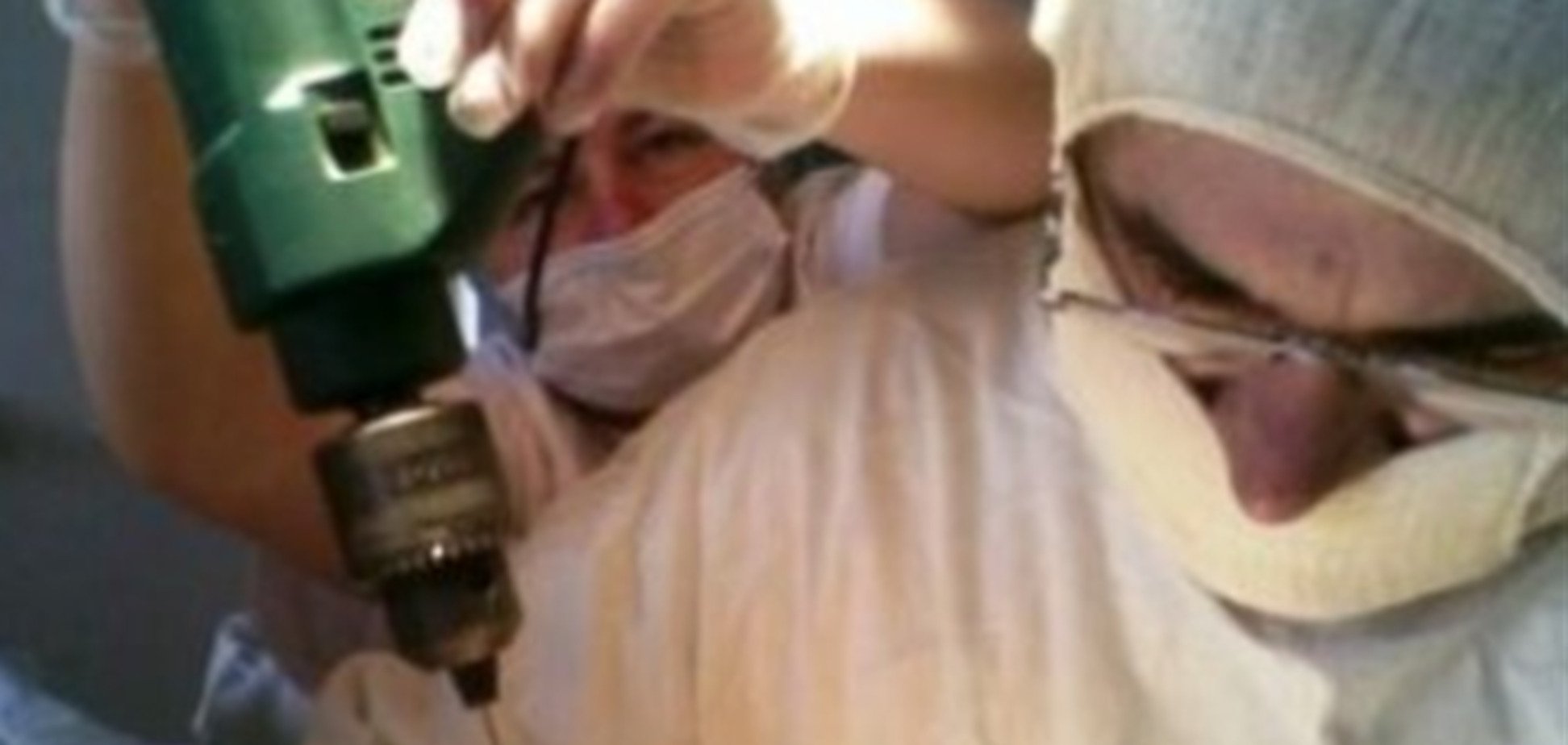 В Молдове требуют наказать врача за операцию со строительной дрелью