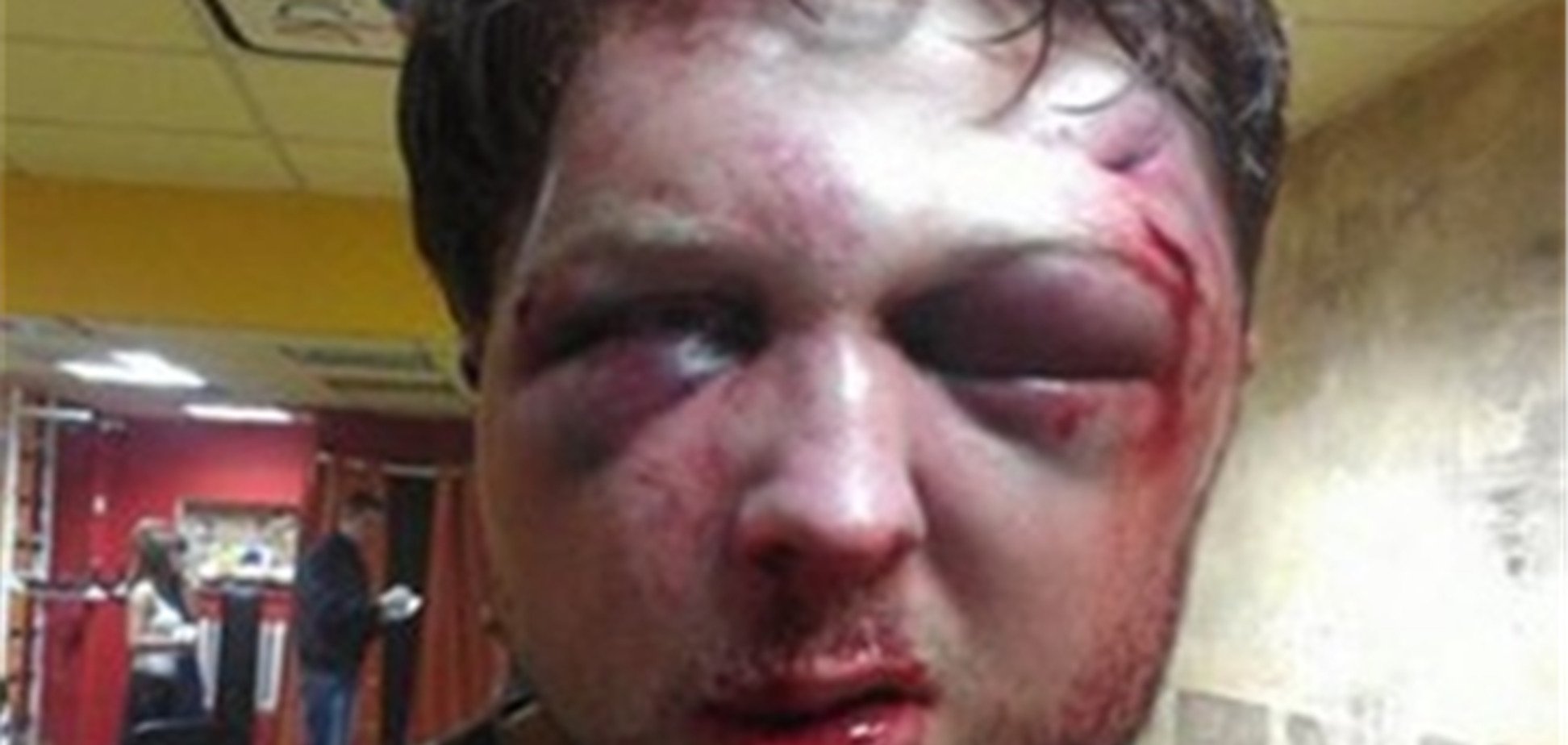 Избиение политолога FEMEN: открыто уголовное производство