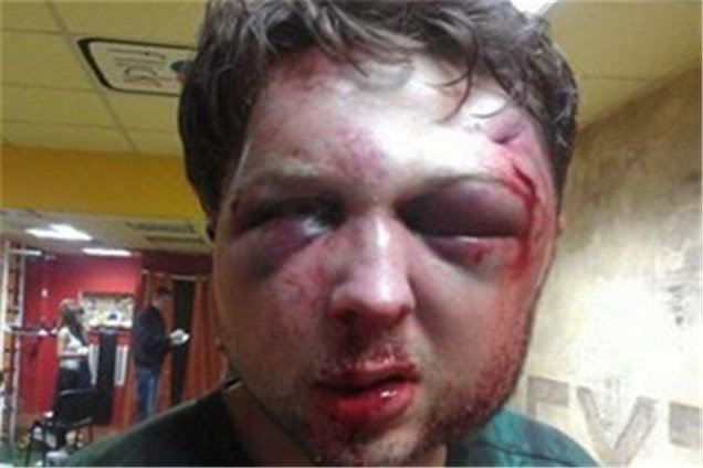 В милиции нет информации об избиении политолога FEMEN