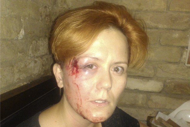 Лидера FEMEN избили в киевском кафе и отобрали ноутбук