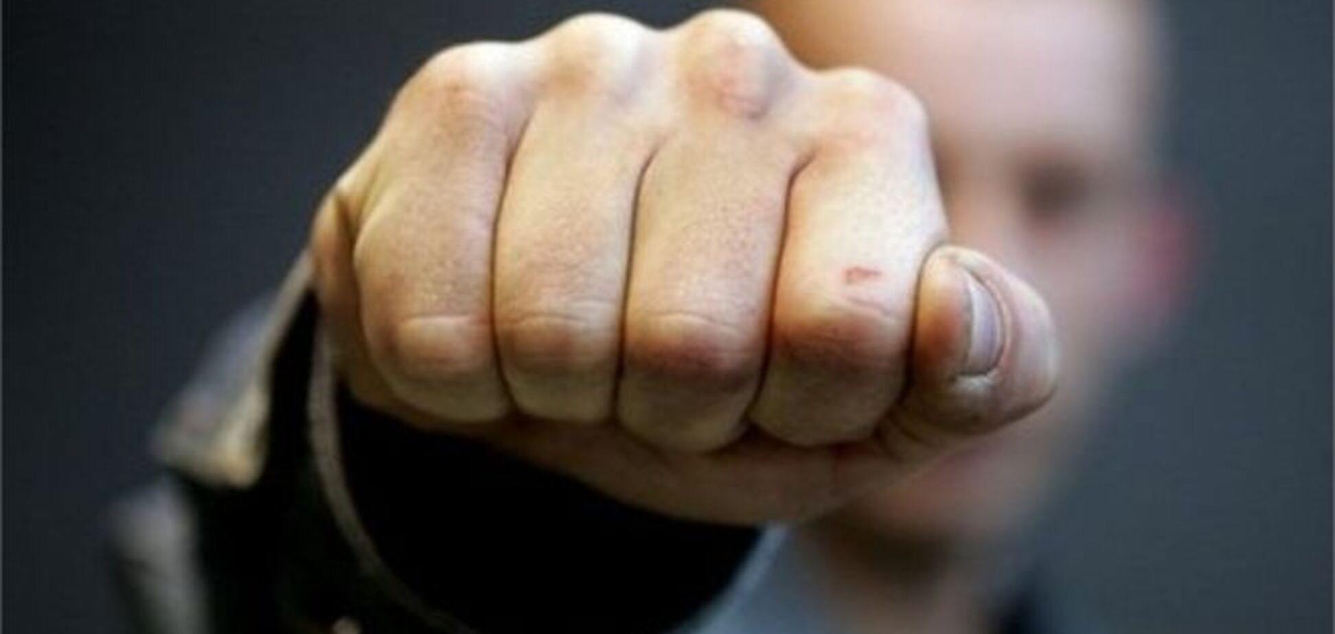 В Луганске жестоко избили тележурналиста