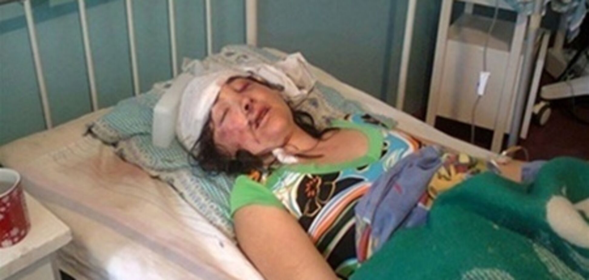 Постраждалу у Врадіївці перевели в окрему палату