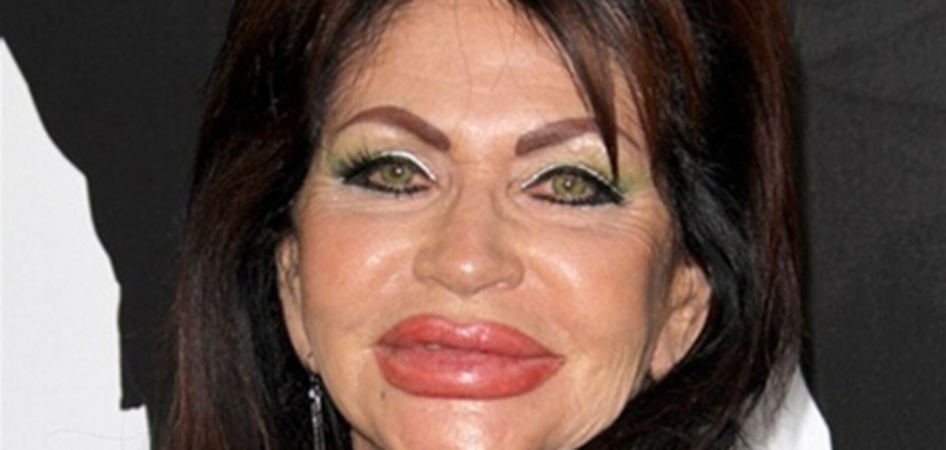 Мать Сталонне изуродовала себя пластикой