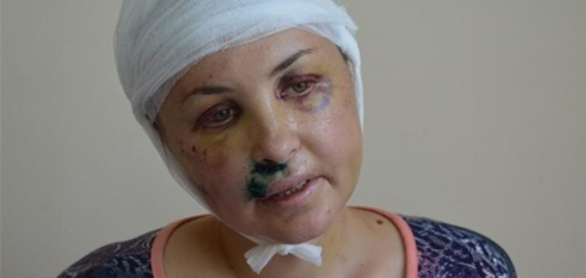 Жертва згвалтування: на упізнанні Дрижак поводився нахабно