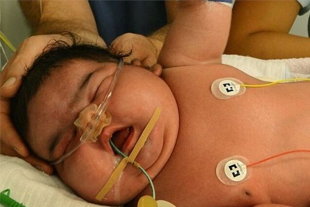 В Германии женщина родила ребенка-гиганта без кесарева