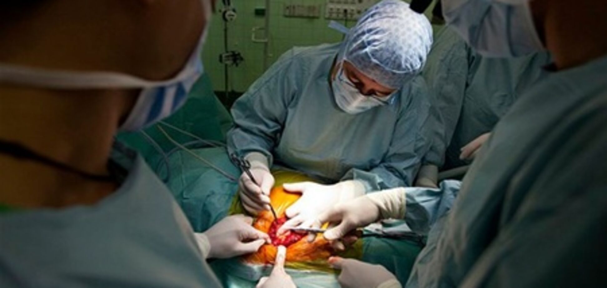 Ученые собираются трансплантировать… голову  
