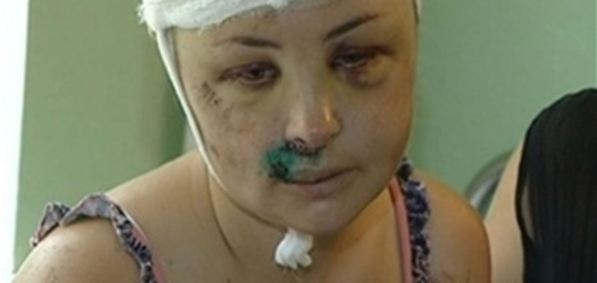 УПЦ КП: врадиевскую жертву спасла от смерти молитва