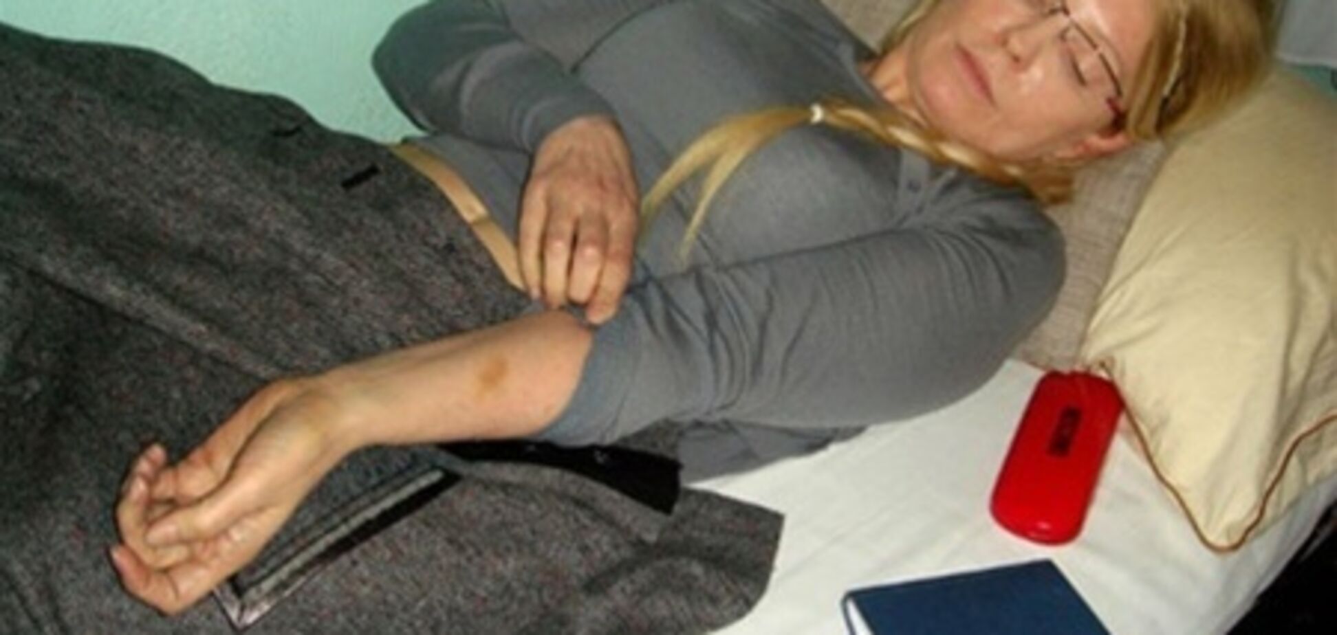 Защита Тимошенко обсуждает с немецкими врачами ее операцию