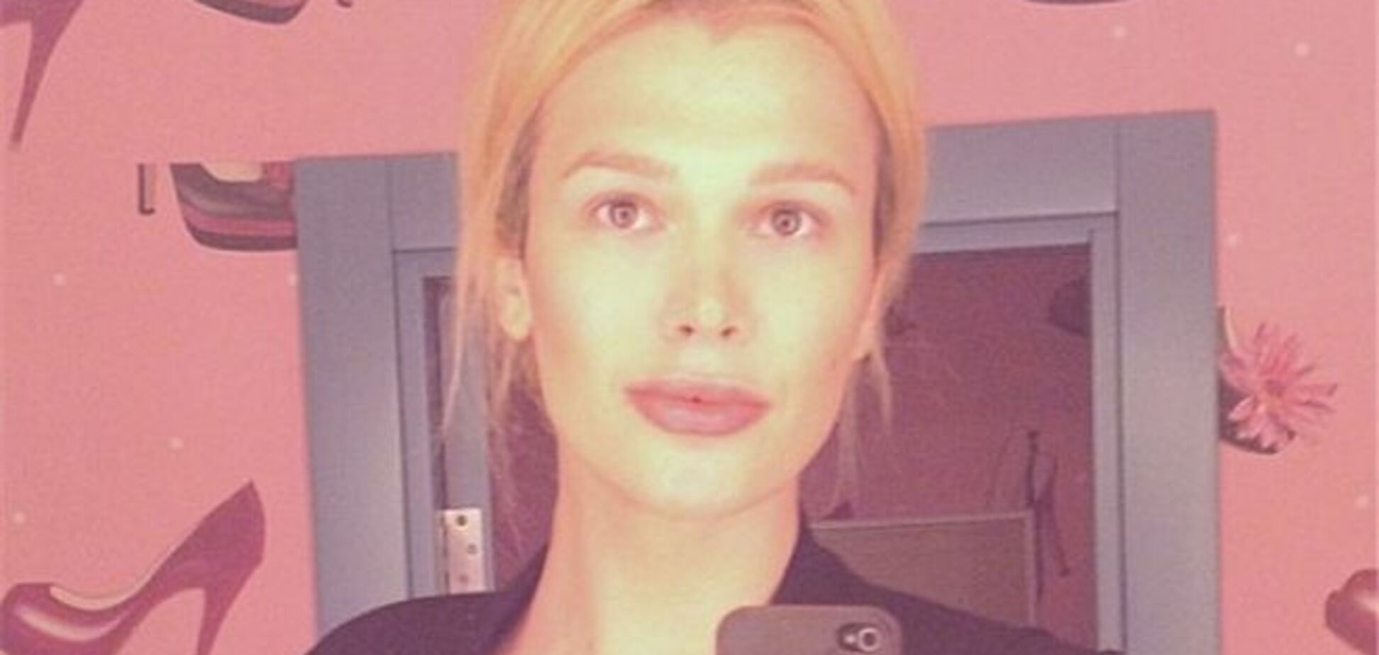 Борис Апрель увеличил себе губы