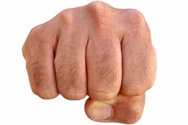 Прокуратура занялась милицейским избиением во Врадиевке