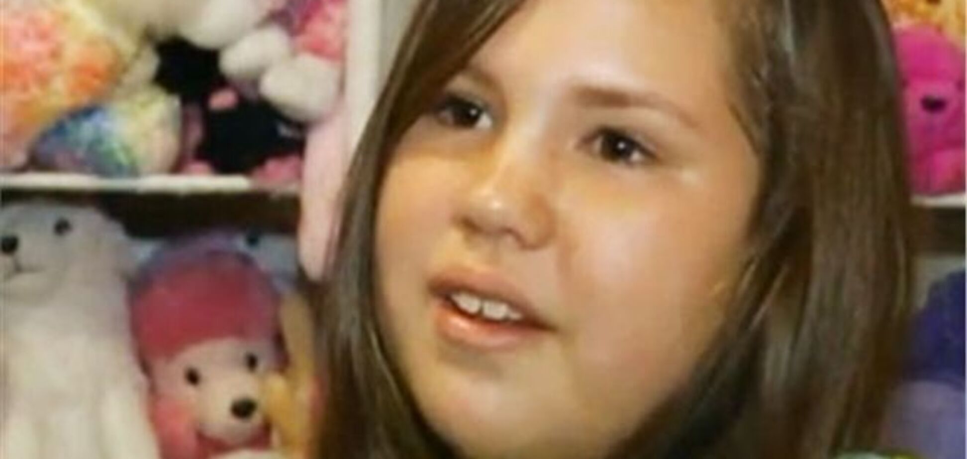 Акула залишила в нозі 11-річної американки зуб