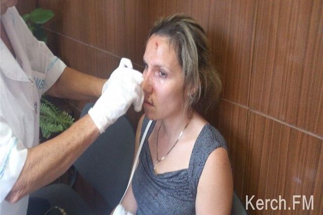 В Крыму депутат до крови избил семейную пару