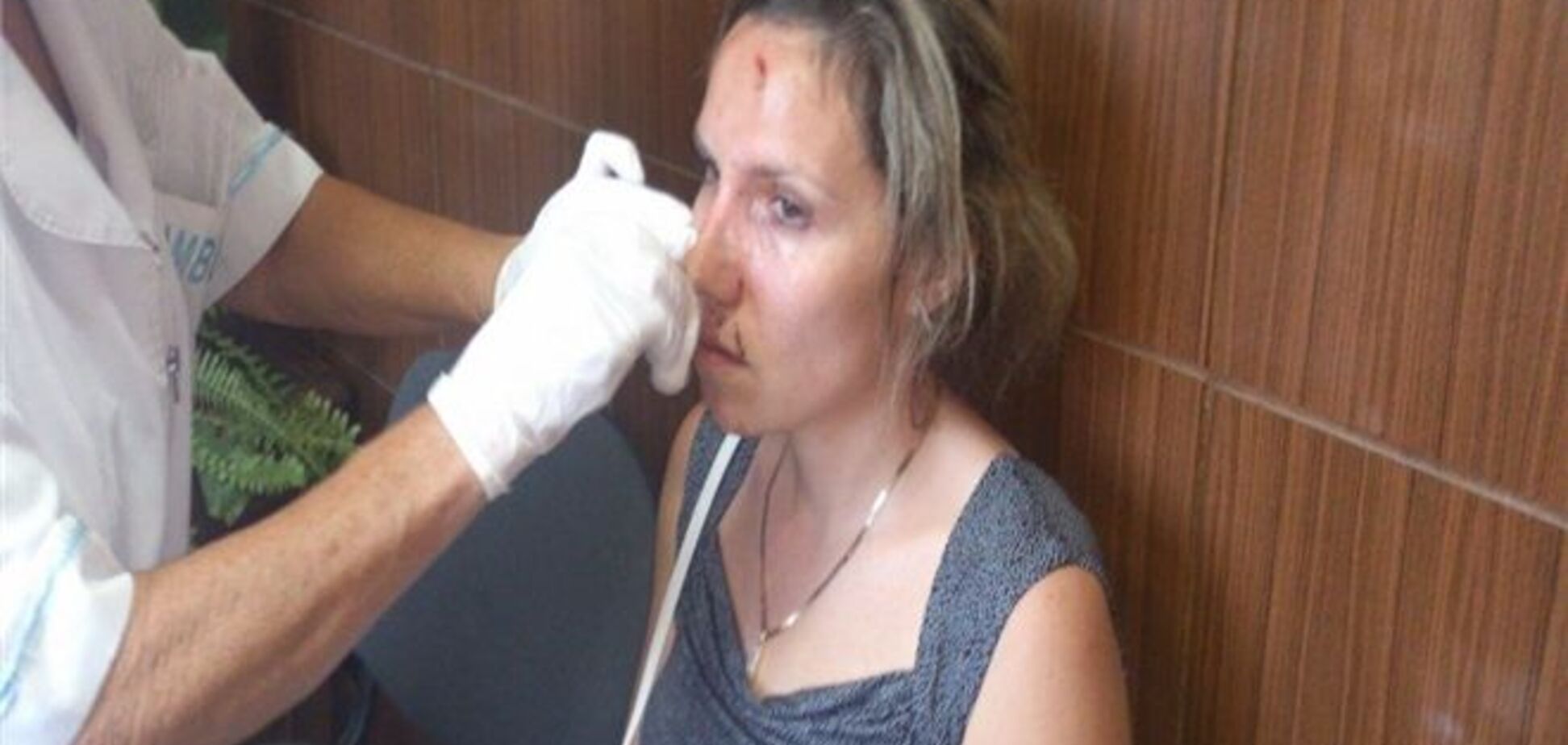 В Крыму депутат до крови избил семейную пару