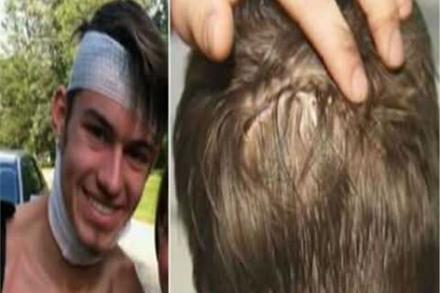 Волк пытался съесть голову 16-летнего парня, пока тот спал