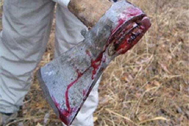 В Одесі чоловік у п'яній сварці відрубав сокирою руку товаришеві