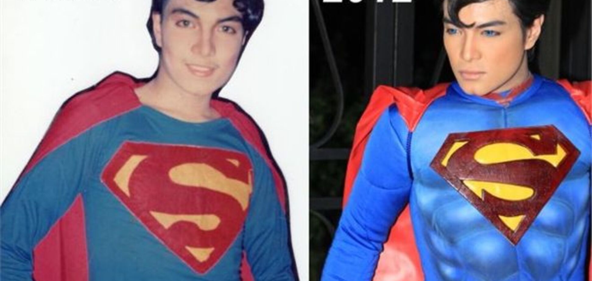 Мужчина пережил 19 пластических операций, чтобы стать Суперменом