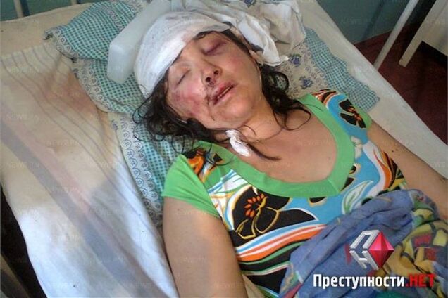 Гвалтівники з Врадіївки користувалися презервативами - адвокат