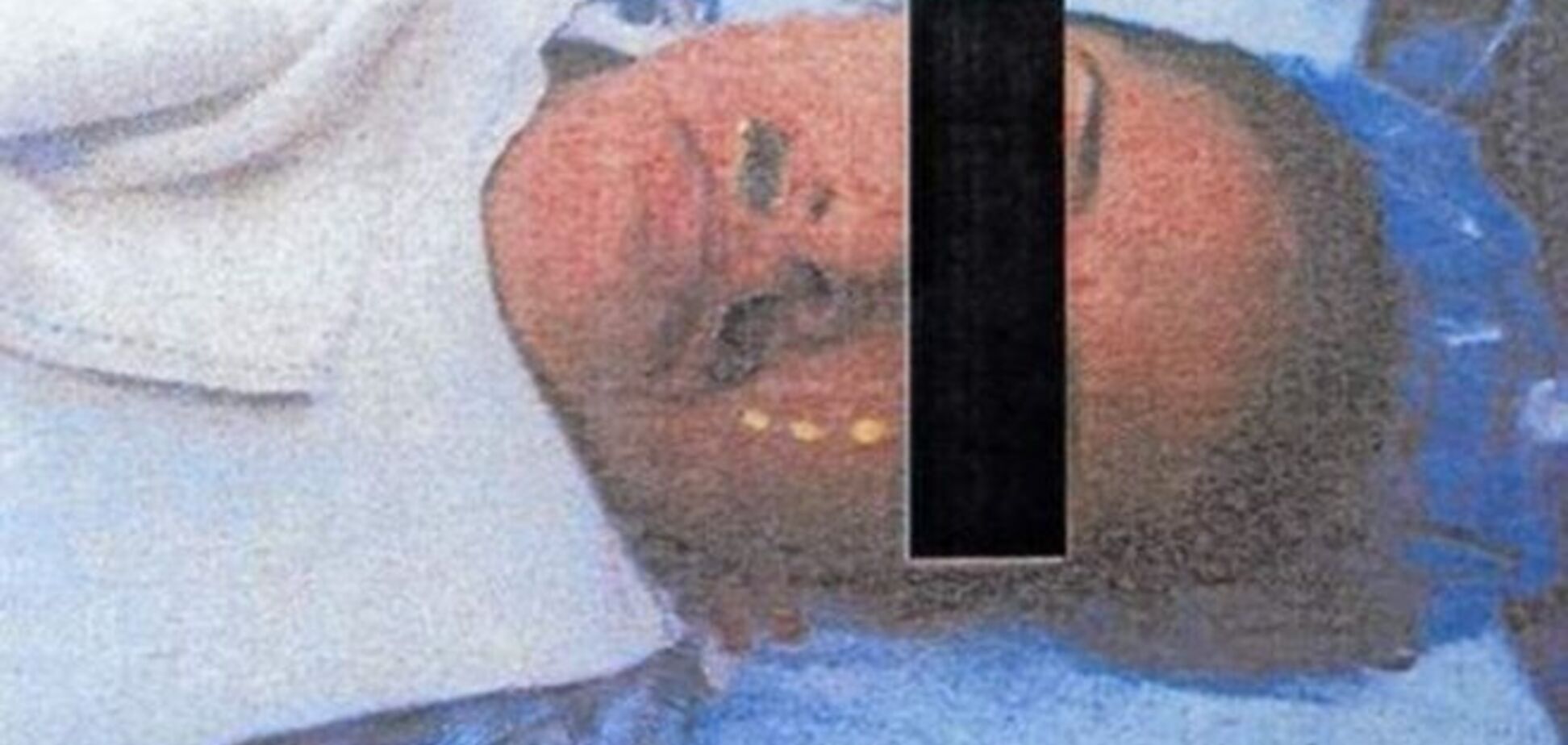 Врач-шутник приклеил женщине усы во время операции