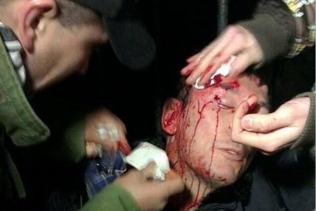 Луценко разбили голову в драке с 'Беркутом'