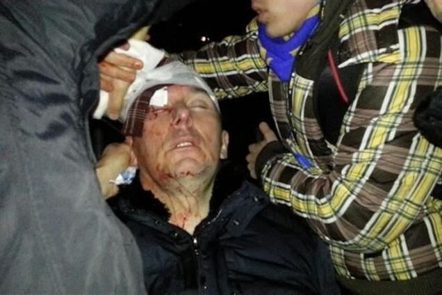 У Луценко нет серьезных травм, однако он находится в реанимации – жена экс-министра