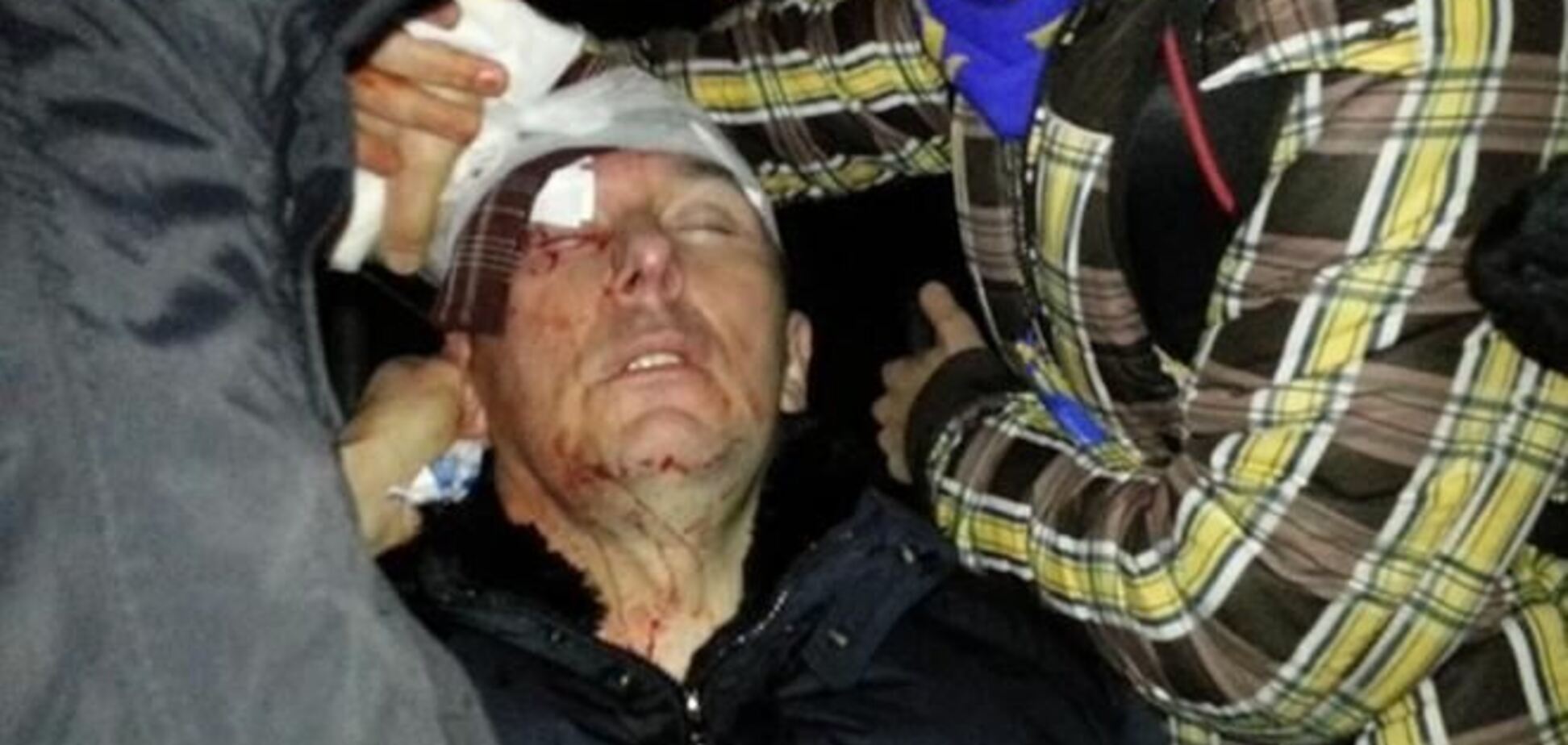 Луценко после стычки с 'Беркутом' попал в реанимацию