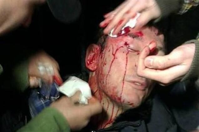 Кровь Луценко проверят на содержание алкоголя - СМИ