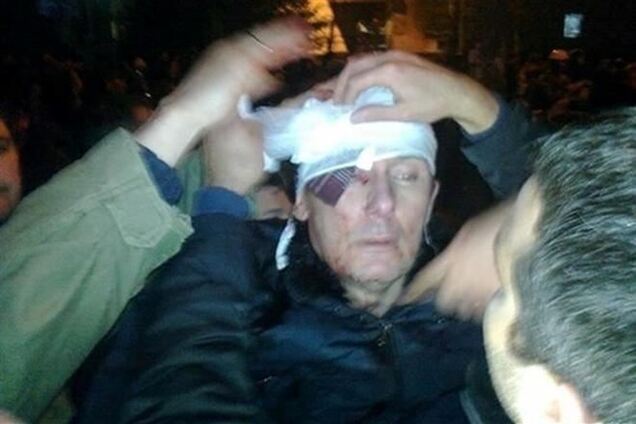 Представитель Луценко: состояние экс-министра ухудшилось