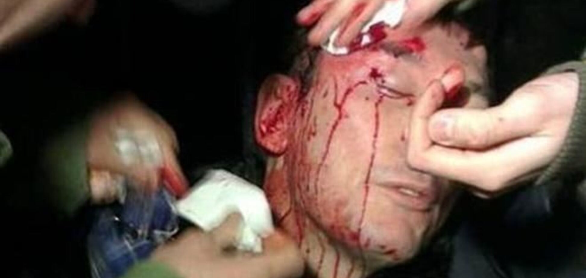 Есть доказательства избиения Луценко сотрудниками 'Беркута' – адвокат