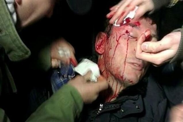 МИД убеждает дипломатов, что 'Беркут' не бил Луценко – жена экс-министра