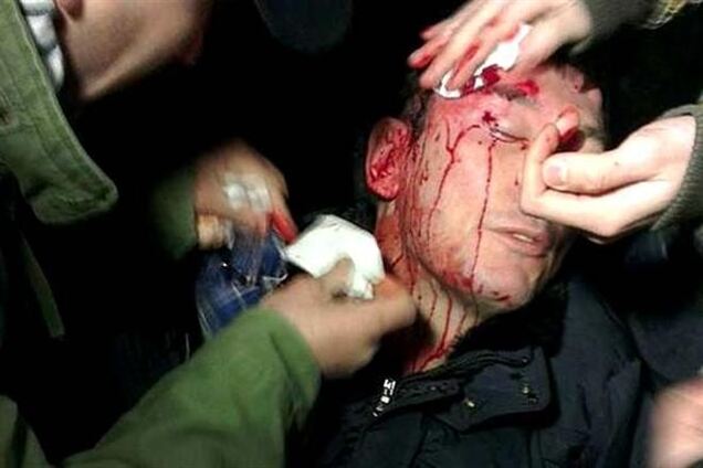 В сети появилось видео избиения Луценко 'беркутовцами'