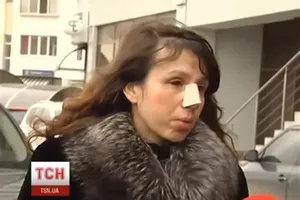 Журналистку Чорновил выписали из больницы