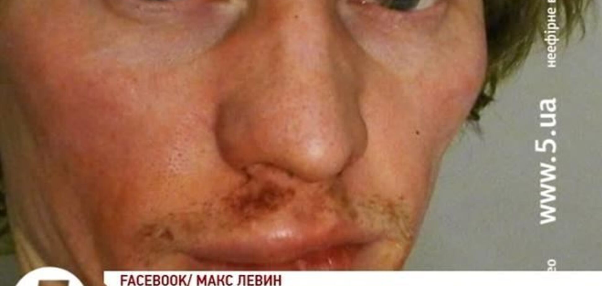 В Киеве неизвестные избили фотокорреспондента