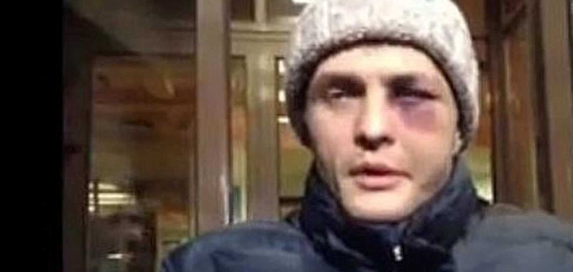 Побитий Ігор Луценко дав перше інтерв'ю після викрадення