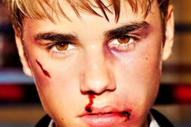 Джастина Бибера арестовали в Майами