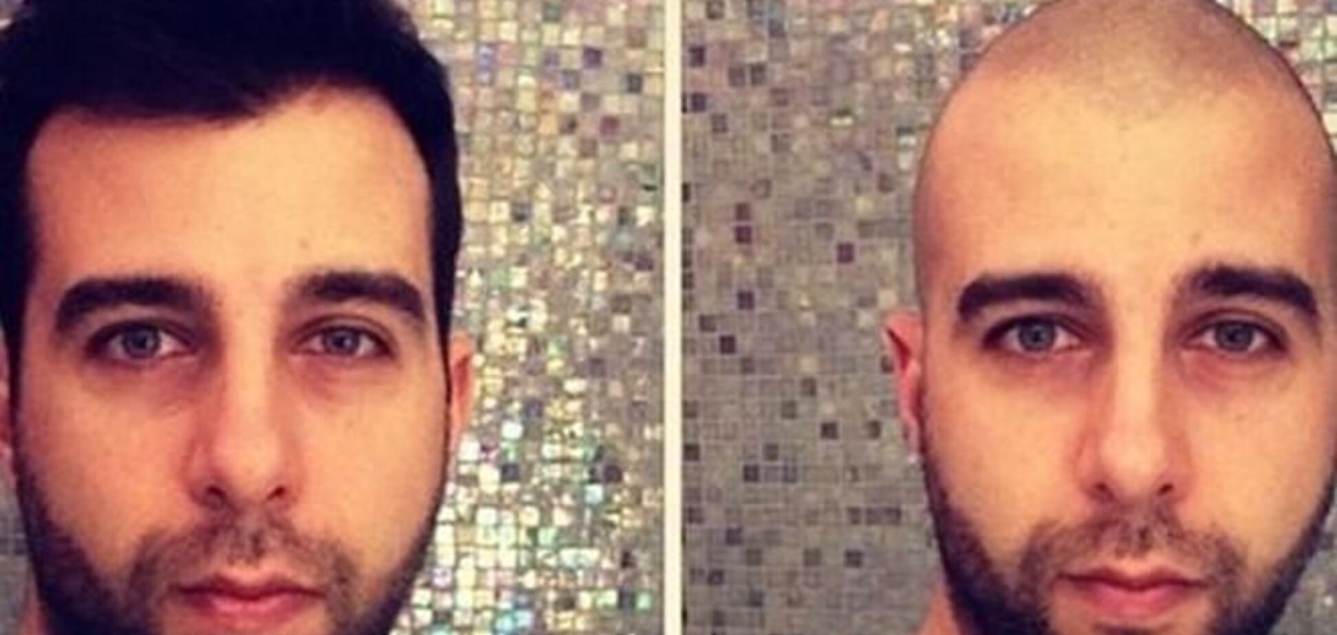 Иван Ургант побрился налысо