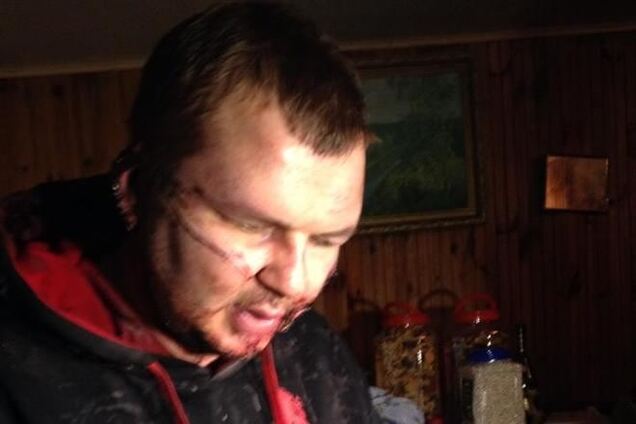 Булатова распяли и отрезали ухо