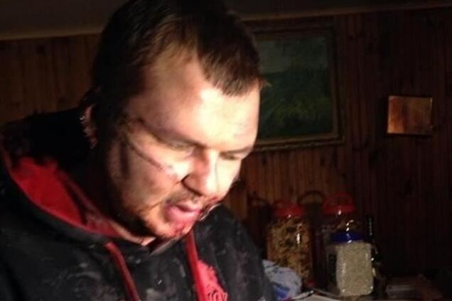 Милиция пытается арестовать Булатова в больнице - Княжицкий