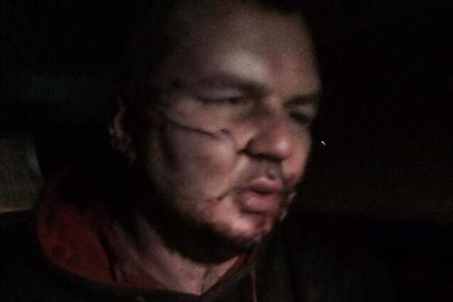 Появились первые результаты медосмотра Булатова