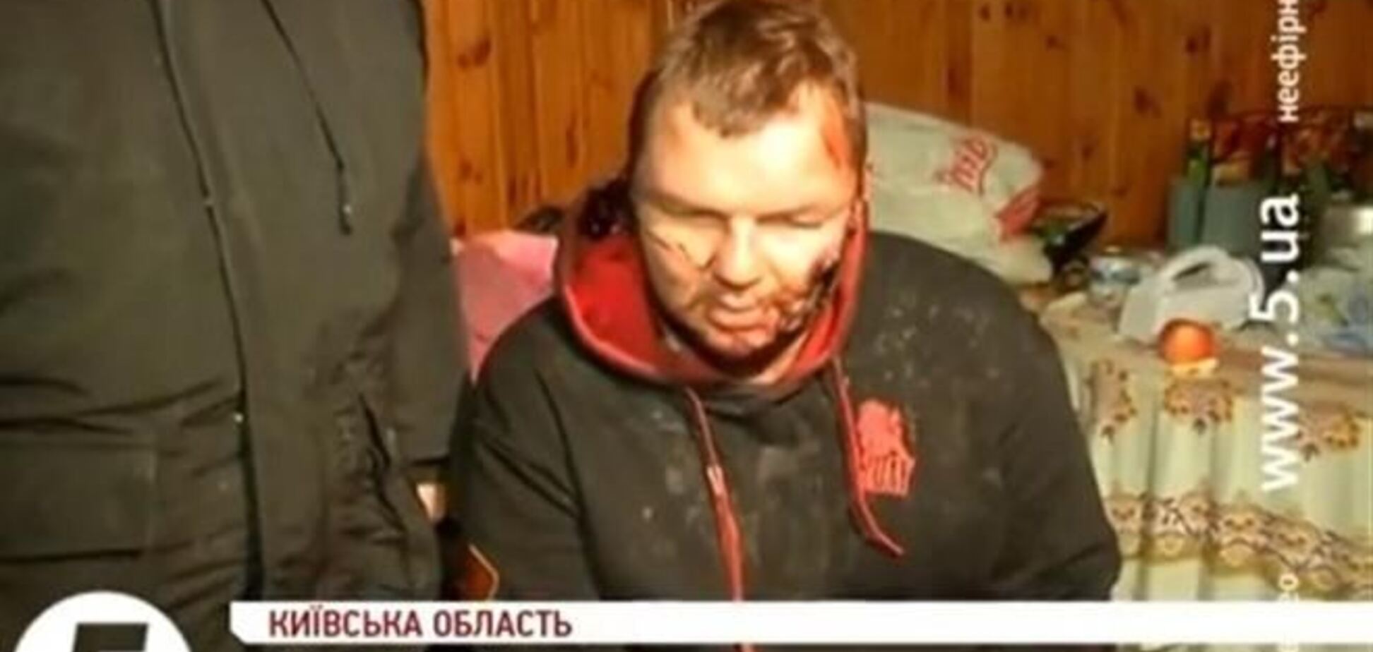 Булатов пришел в село весь в крови - местный житель 