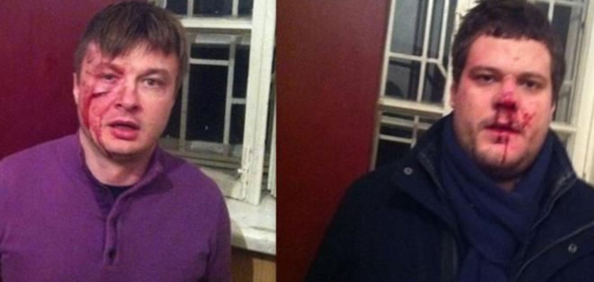 Ильенко подозревает милицию в своем избиении