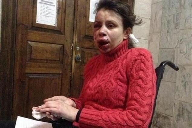 Муж Чорновил назвал неправдивым заявление Минздрава о ее нормальном состоянии