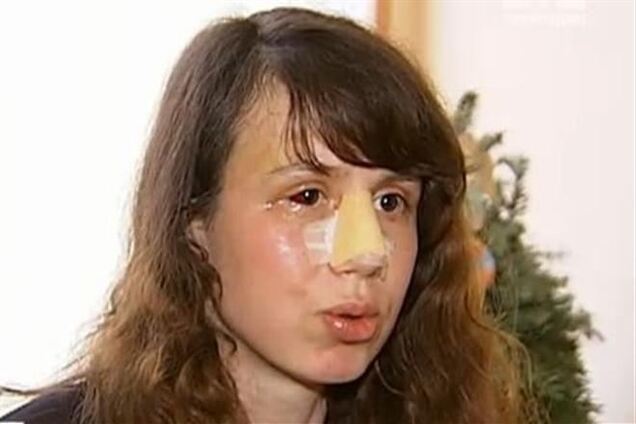 Чорновіл каже, що в день побиття за нею стежили дві машини