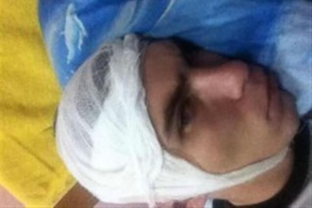 В Днепропетровске прямо в гастрономе избили активиста Евромайдана