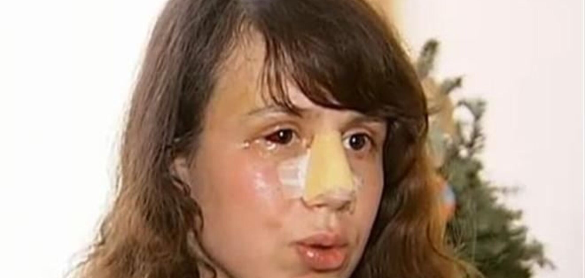 Медики рассказали, сколько еще Чорновил будет находиться в стационаре