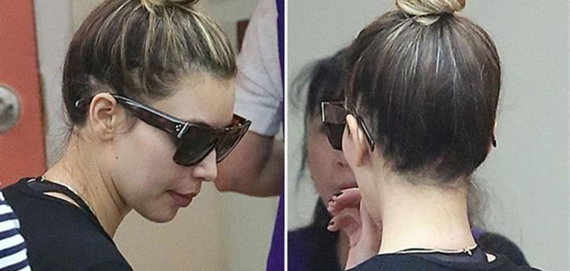 Из-за диеты после родов Ким Кардашьян стала лысеть