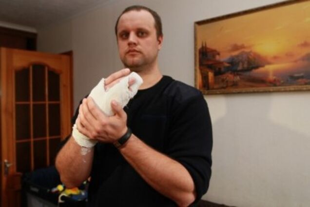 Гиркин рассказал российским СМИ о состоянии Губарева