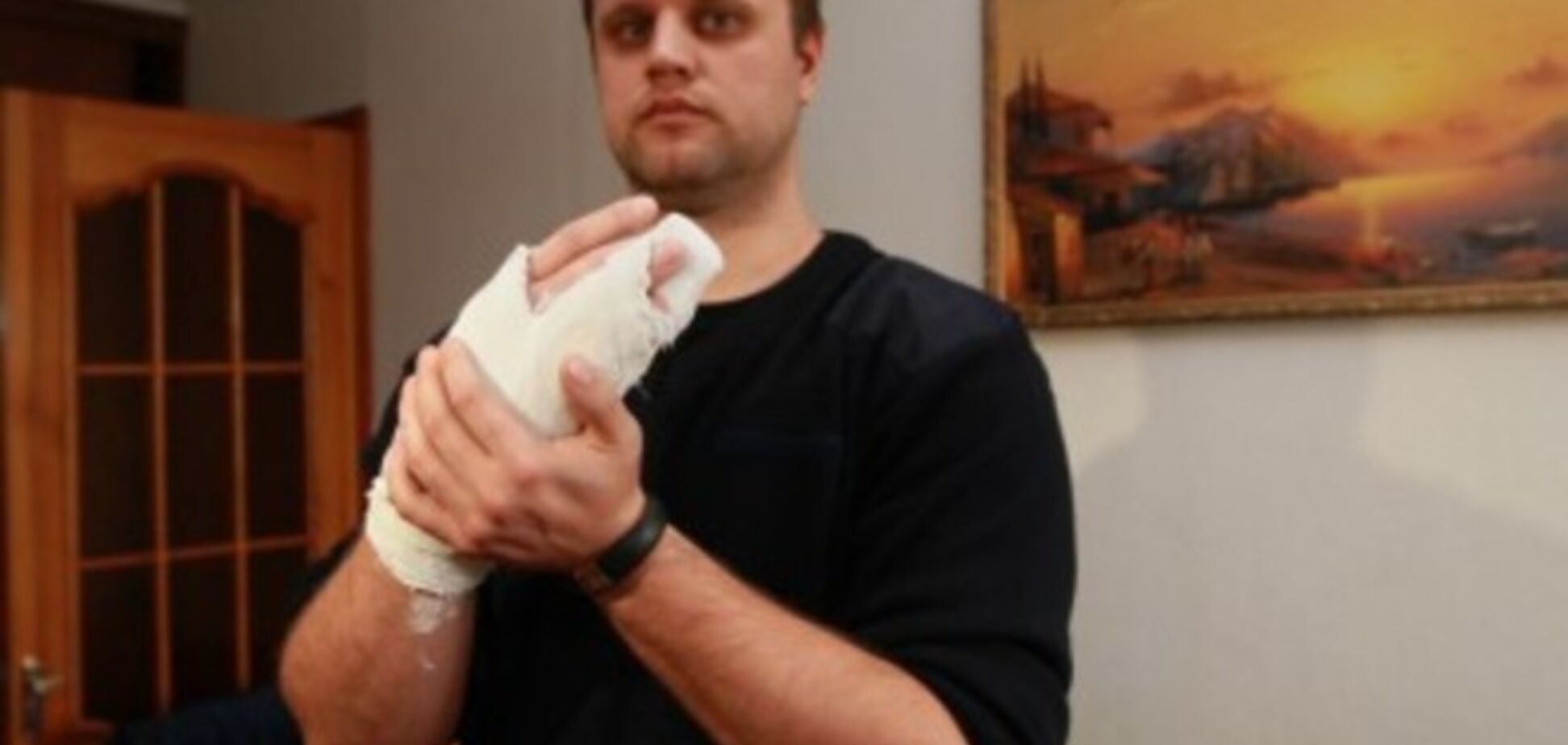 Полиция и Минздрав Ростовской области не подтвердили информацию о госпитализации Губарева