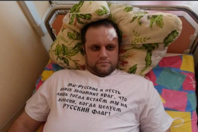 Опубликованы первые фотографии раненного в голову Губарева на больничной койке